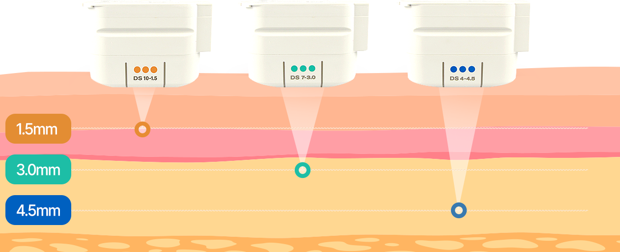 실리프팅 얼굴 윤곽, 탄력
