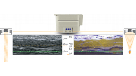 지방분해주사 얼굴 윤곽, 탄력